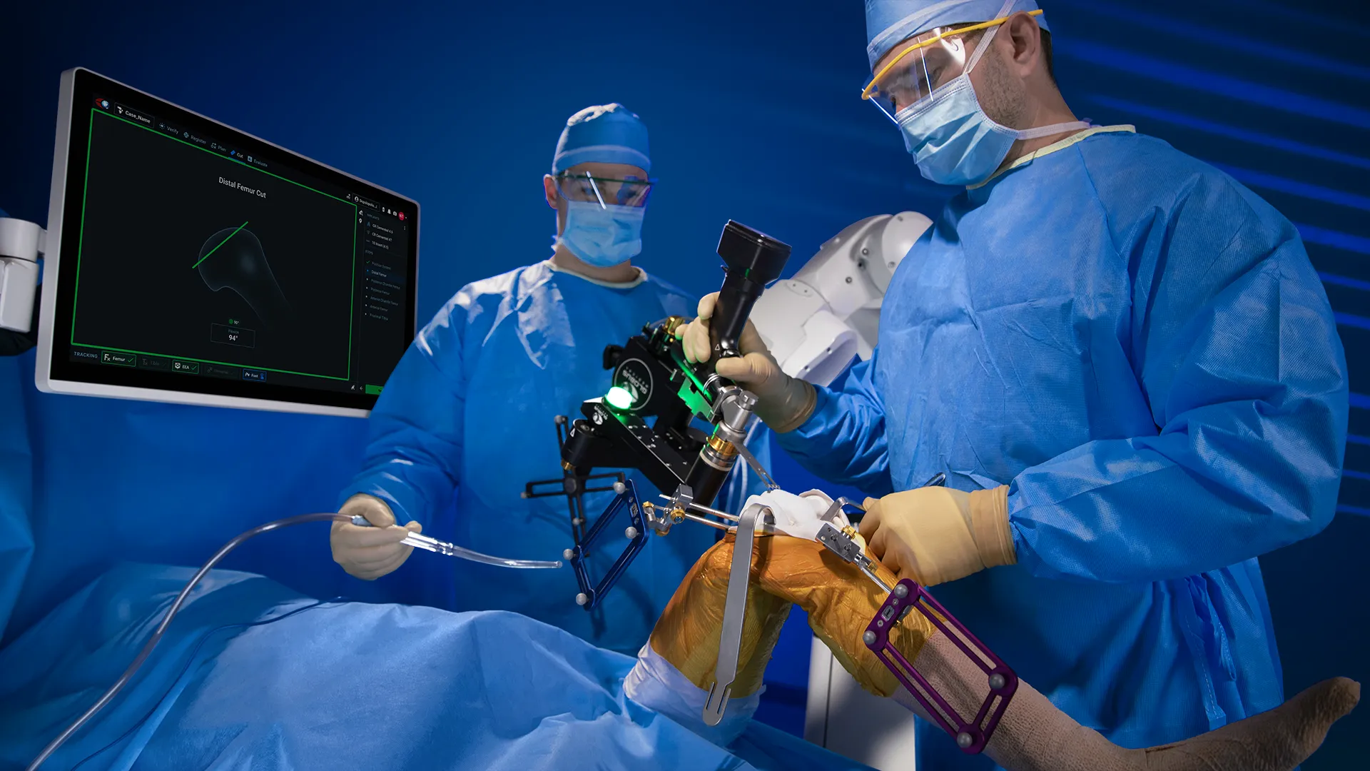 Surgeon using ExcelsiusFlex