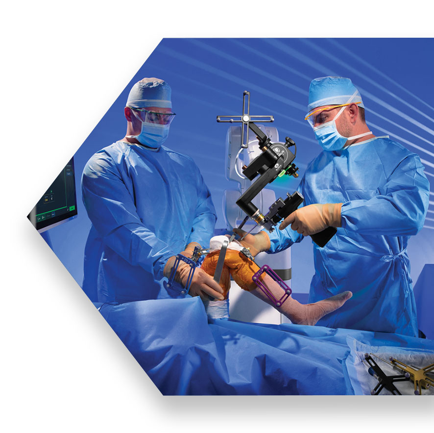 Surgeon cutting tibia using ExcelsiusFlex