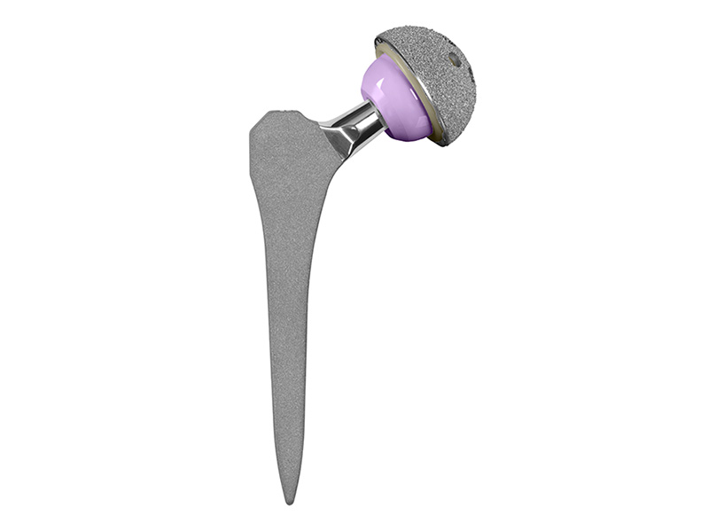 ProClass™ Femoral Hip System | Globus Medical